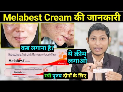 melabest cream uses in hindi - सब दिक्कतें khatam / hydroquinone ...