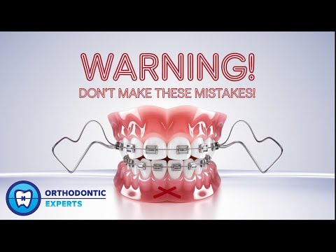Common Mistakes During Braces Treatment: What Not To Do thumbnail