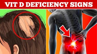 Information 10 Weird Symptoms Of Vitamin D Deficiency News