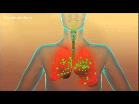 Vídeo: Diferencia Entre Asma Y Bronquitis