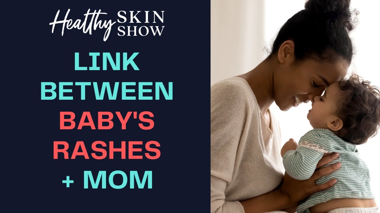 MISSING LINKS Between Your Little One's Skin Rashes & Mom's Health ...