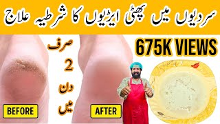 Remove Cracked Heels Remedy | Get Beautiful Feet Permanently In 2 Day | Homemade Oil | BaBa Food RRC