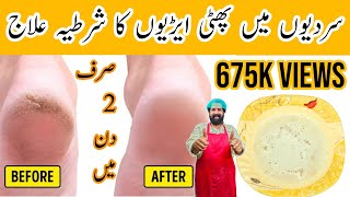 Remove Cracked Heels Remedy Get Beautiful Feet Permanently In 2 Day Homemade Oil Baba Food Rrc