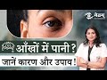 Cause of Watery Eyes | आंखों में पानी आने का कारण? | Aankho me pani aane ka ilaj | Netram Eye
