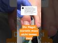 Die Nagel wurzeln muss nicht immer raus 