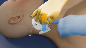 Tegaderm™ IV Advanced Dressing 1685 for IJ Application Video