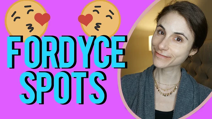 Fordyce spots| Q&A with dermatologist Dr Dray