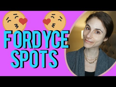 Fordyce spots| Q&A with dermatologist Dr Dray