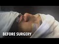 Best nose reshaping in pakistan  dr arfat jawaid