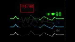 E.C.G Monitor - With Pulse  - without grid