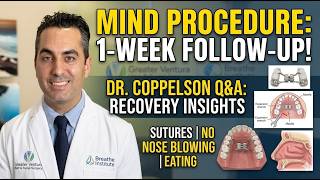 MIND Procedure 1 Week Post-Op: Doctor Checks My Jaw & Answers ALL My Questions