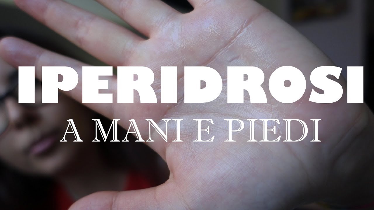 UN ALTRO PROBLEMA IPERIDROSI In Mani E Piedi YouTube un-altro-problema-iperidrosi-in-mani-e-piedi-youtube