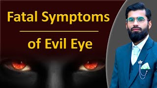 Fatal Symptoms of Evil Eye| Evil Eye Symptoms| Evil Eye Treatment| Gulfam Riaz Hashmi