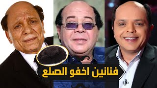 10 فنانين اخفو الصلع بتركيب الشعر الصناعي !!