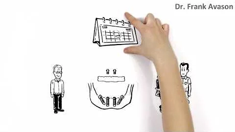 Permanent Dentures in 1 Day