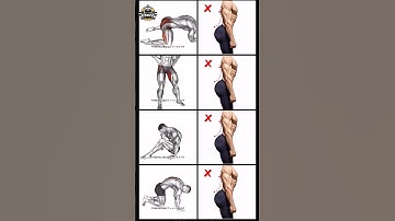 How To Fix Anterior Pelvic Tilt