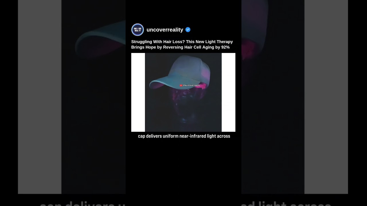 Struggling With Hair Loss? This Light Therapy Brings Hope By Reversing Hair Cell Aging 