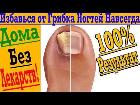 Избавься от Грибка