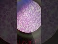#NORMOCYTIC NORMOCHROMIC ( Microscopy)