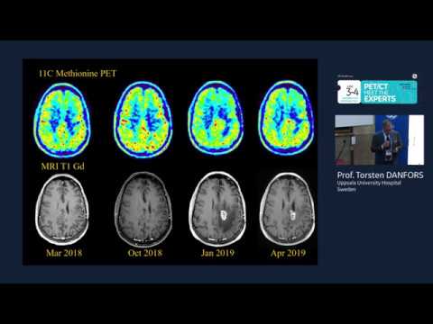 Clinical trends and new tracers for Neuro-PET/CT