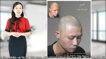 Xăm tóc, xăm chân tóc