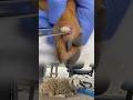 Amazing Veterinary Procedure – Worm Removal From Dog’s Injured Leg!