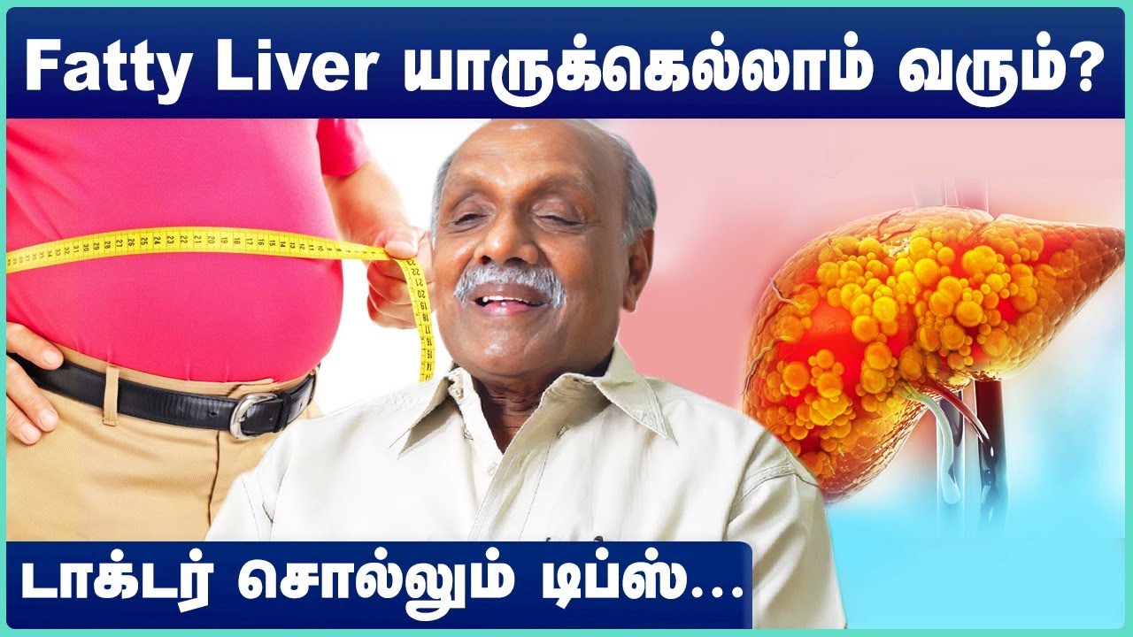 Fatty Liver Treatment | Fatty Liver Diet | Fatty Liver | Fatty Liver Symptoms | Dr Chockalingam