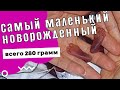 Самый маленький ребенок родился и выжил! Его вес всего 280 грамм.