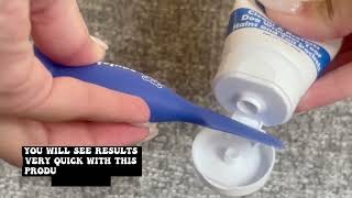 How To Clean Your Bulldog Stinky Wrinkles- IT WORKS!
