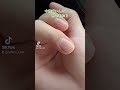 【急募】指が緑になってきた時の対処法