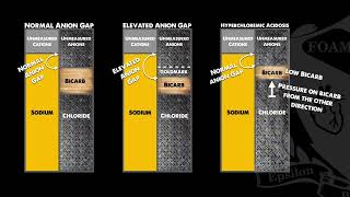 Anion Gap