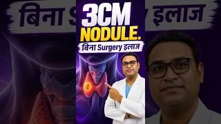 3 CM Gaanth… kya Surgery avoid kar sakte hain.
