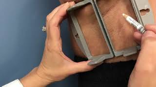 Axillary hyperhidrosis treated with SculpSure screenshot 5