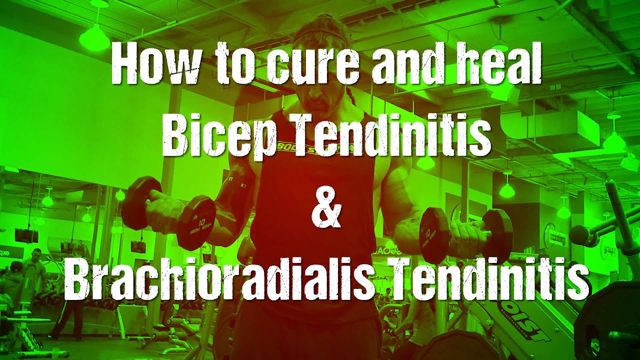 Bicep tendonitis & brachioradialis/forearm tendinitis - YouTube