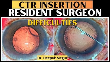 Difficulties faced by a trainee surgeon during CTR Insertion - Dr. Deepak Megur
