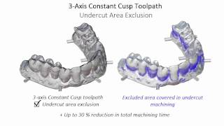 Moduleworks Dental Framework - 3Axis Constant-Cusp Undercut Exclusion
