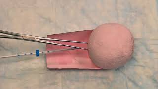 Hormonal IUD (LNG-IUS) Insertion Technique (French Language)