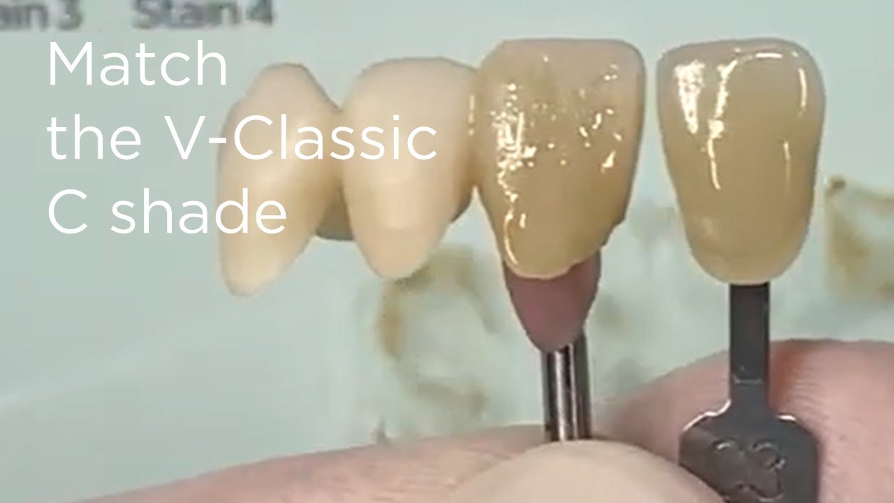 Monolithic zirconia C shade matching YouTube