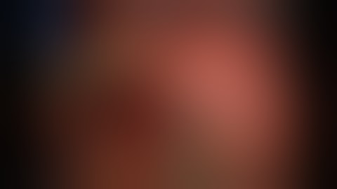 Robotic Partial Nephrectomy -  Solitary Kidney