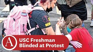 USC Freshman Blinded at No Kings Protest - ATVN, Tuesday, April 7th, 2026