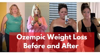 Ozempic Weight Loss Before and After | Pepper Schwartz Weight Loss