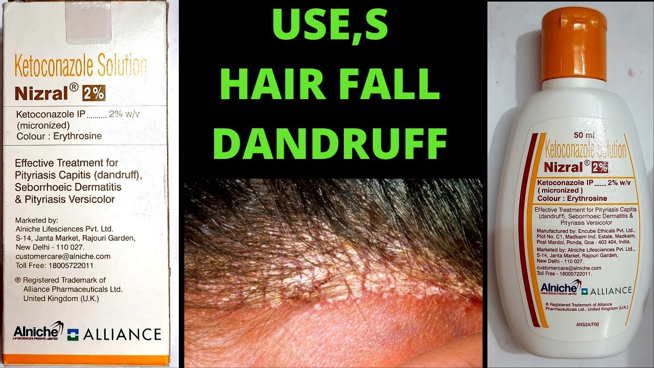 Nizral shampoo use in hindi anti dandruff how to use nizral 2% solution