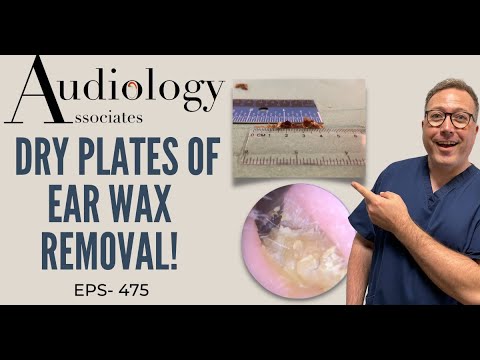 DRY PLATES OF EAR WAX REMOVAL - EP475