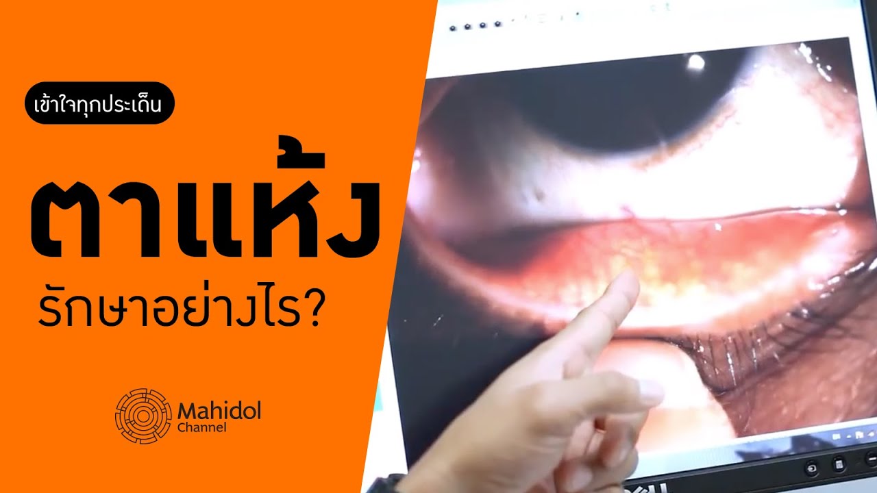 'ตาแห้ง' รักษาอย่างไร? [หาหมอ by Mahidol Channel]