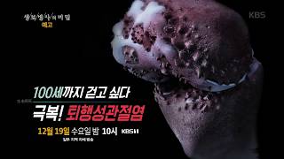 20181219 생로병사의비밀 예고 ㅣ KBS방송