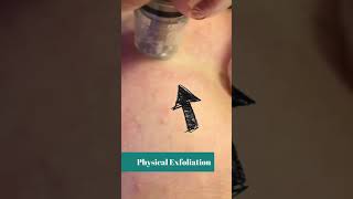 Microdermabrasion | Understanding SkinCare Procedures with Dr Erum Ilyas