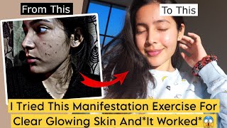 From Acne To Radiant: Here's What I Did To Manifest Clear Glowy Skin (My Manifestation Story) screenshot 5