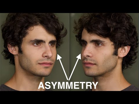 My MSE Asymmetry - A Closer Look