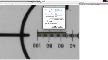 Image J Set Scale Tutorial.