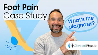 Foot Pain Case Study | Expert Physio explains Key Details for Interesting Patient Case!